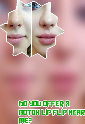 Botox and lip injections near me