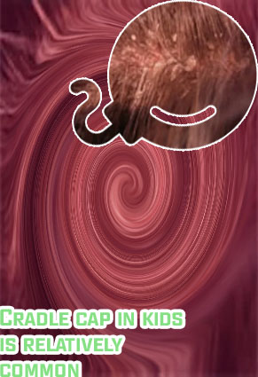 Yellow flaky skin on scalp